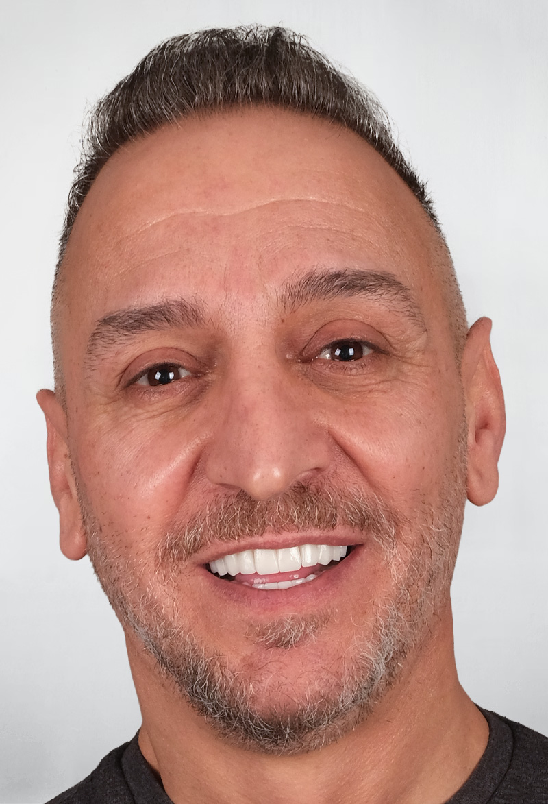 Patient smile 8