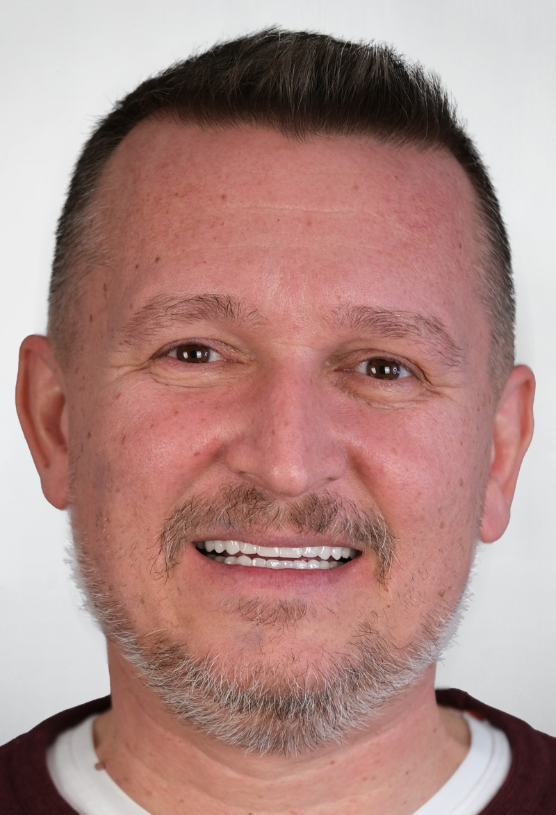 Patient smile 9