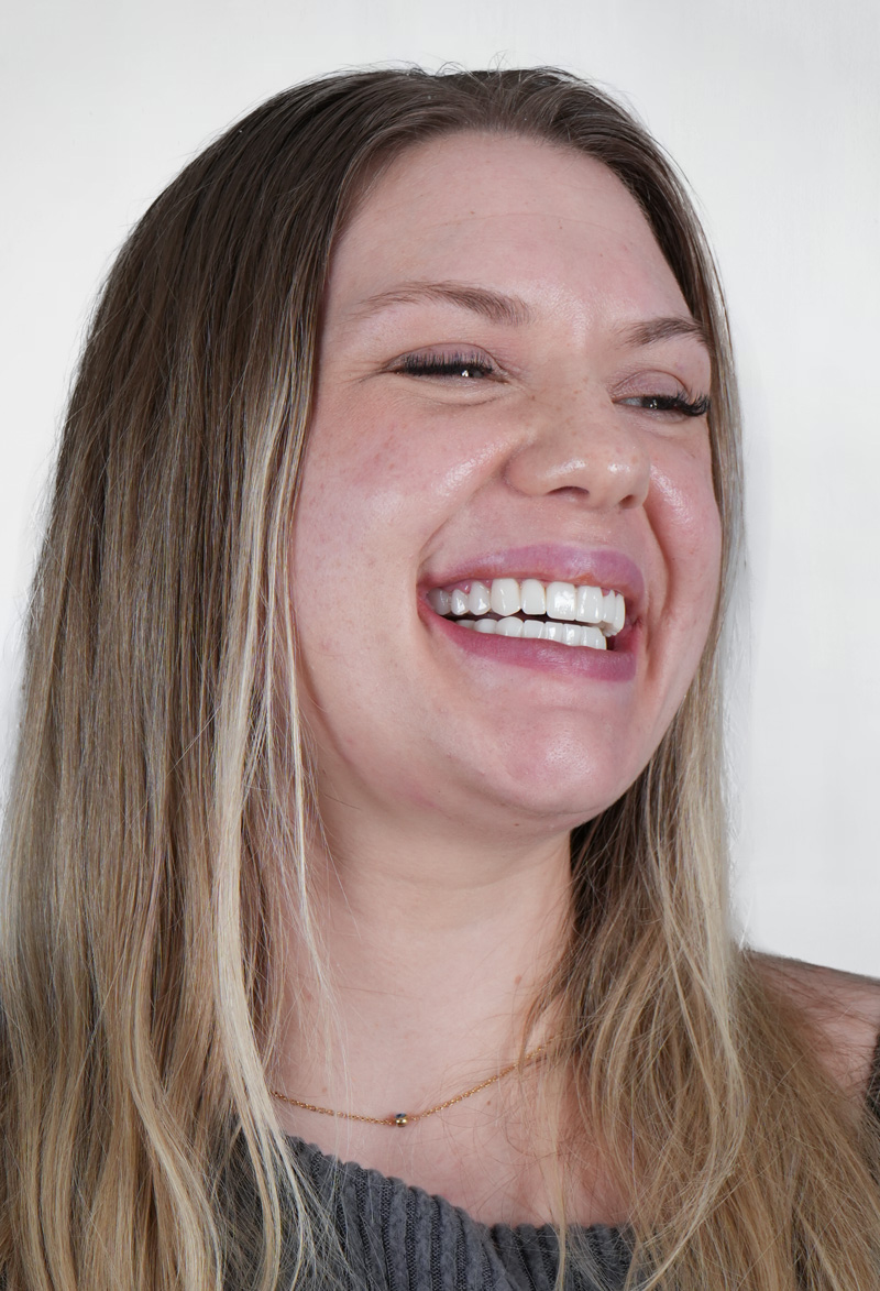 Patient smile 10